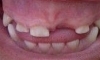 Güzel dişler